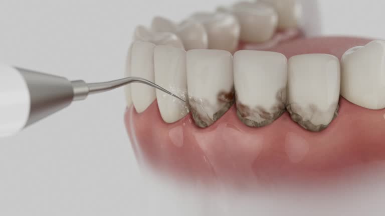 Trusted Tooth Extraction service in Port Carbon, PA - Dentist Open Now